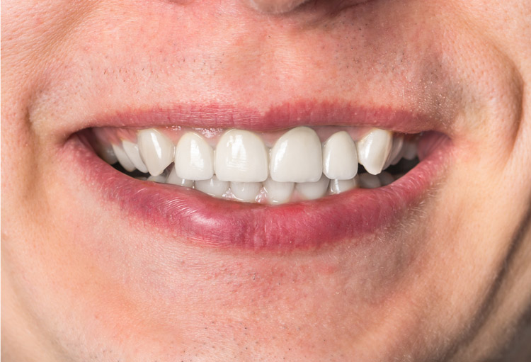 Orthodontics After